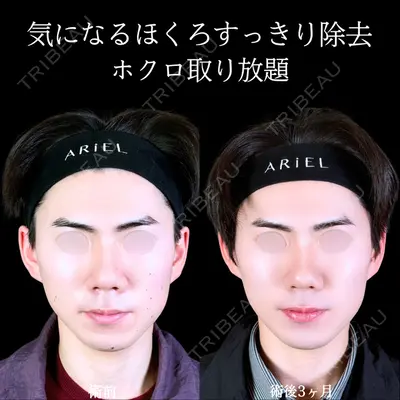 アリエル美容クリニック 郡山院 安齋 誠基医師の症例