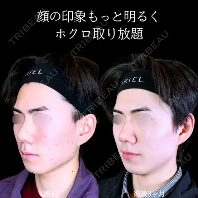 アリエル美容クリニック 郡山院 安齋 誠基医師の症例