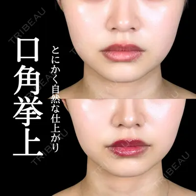 アリエル美容クリニック 大宮院 阪野 一世医師の症例