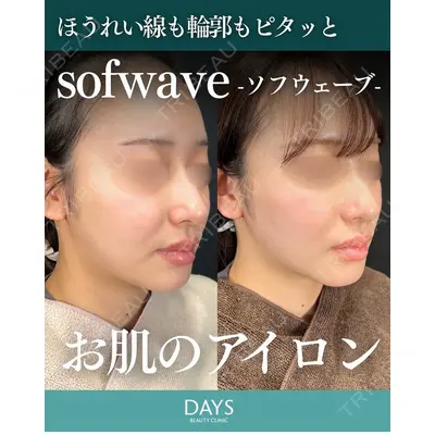 Days Beauty Clinic 新宿院の症例