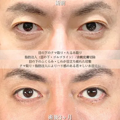 アリエル美容クリニック 大宮院 鈴木　桂介医師の症例