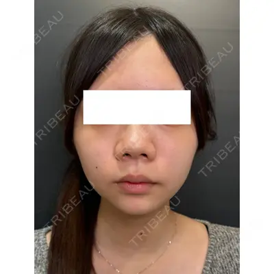 Ledian Clinic六本木の症例