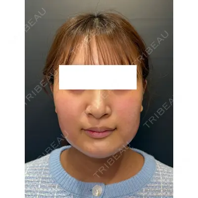Ledian Clinic六本木の症例