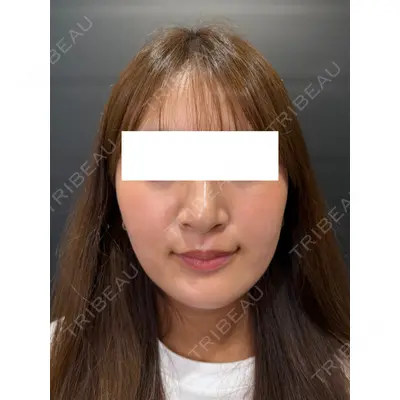 Ledian Clinic六本木の症例