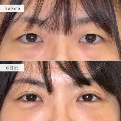 nico wellness デンタルクリニック広尾 佐藤 大晟医師の症例