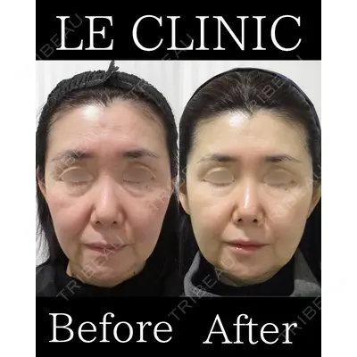 LE CLINICの症例