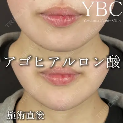 YBC横浜美容外科 立川院 大島 諒士医師の症例