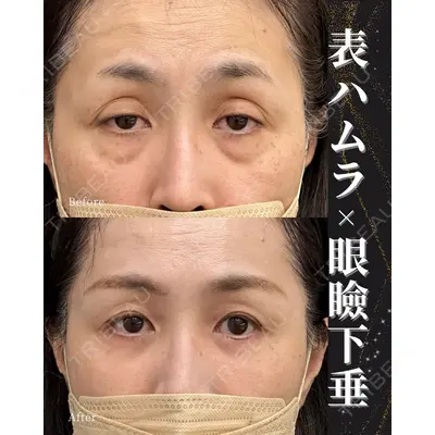 お茶の水美容形成クリニック 山田 淳生医師の症例