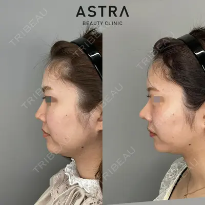 ASTRA BEAUTY CLINICの症例