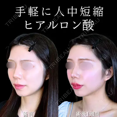 アリエル美容クリニック 水戸院 天白 典秀医師の症例