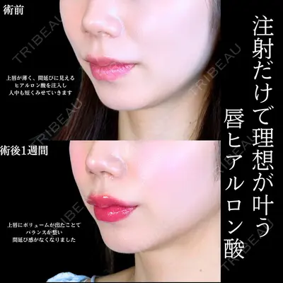 アリエル美容クリニック 水戸院 天白 典秀医師の症例