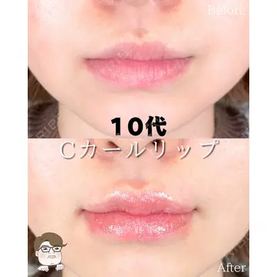ルラ美容クリニック 札幌本院 佐藤 雄紀医師の症例