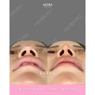 ASTRA BEAUTY CLINIC 河口 はるか医師の症例