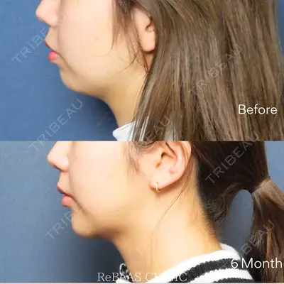 ReBeAS CLINICの症例