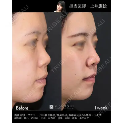 X CLINIC 恵比寿院 上井 廉絵医師の症例
