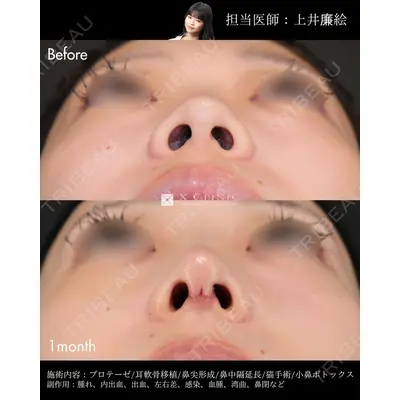 X CLINIC 恵比寿院 上井 廉絵医師の症例