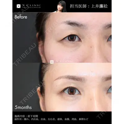 X CLINIC 恵比寿院 上井 廉絵医師の症例