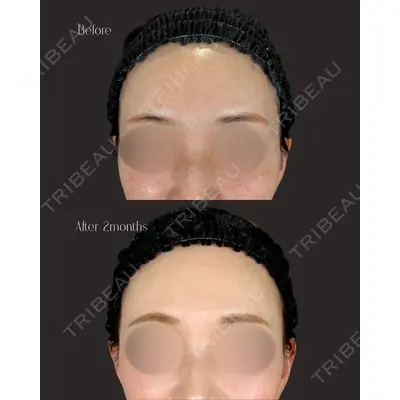 IANA CLINIC 穴井 元康医師の症例
