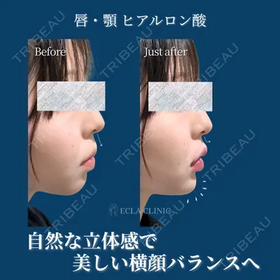 ECLA CLINIC (エクラクリニック) 緒方 善孝医師の症例