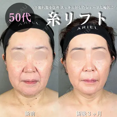 アリエル美容クリニック 大宮院 鈴木　桂介医師の症例