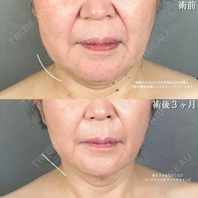 アリエル美容クリニック 大宮院 鈴木　桂介医師の症例