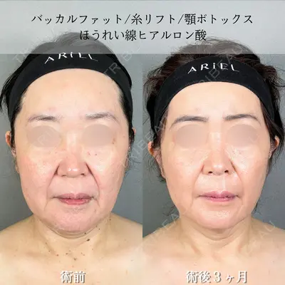 アリエル美容クリニック 大宮院 鈴木　桂介医師の症例