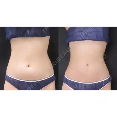 ICON CLINIC 横井 麻人医師の症例