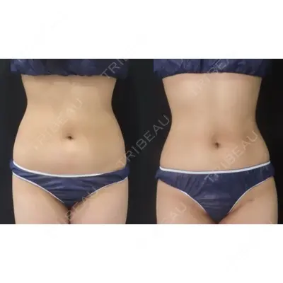 ICON CLINIC 横井 麻人医師の症例