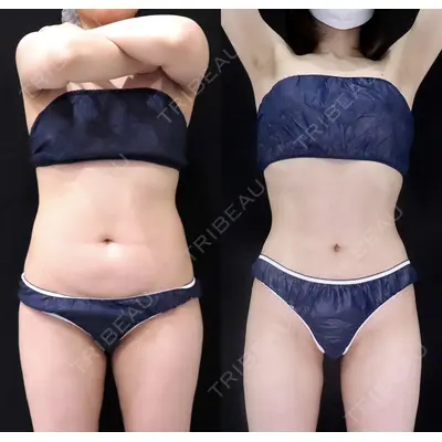 ICON CLINIC 横井 麻人医師の症例
