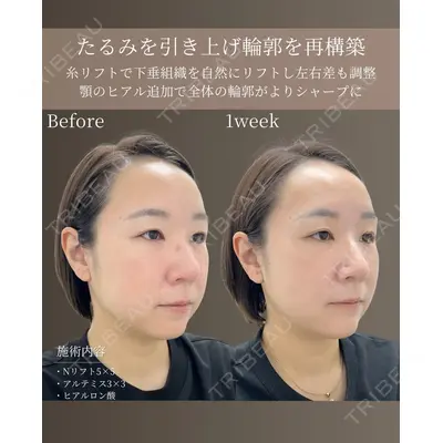 gift clinic 能登谷 翔医師の症例
