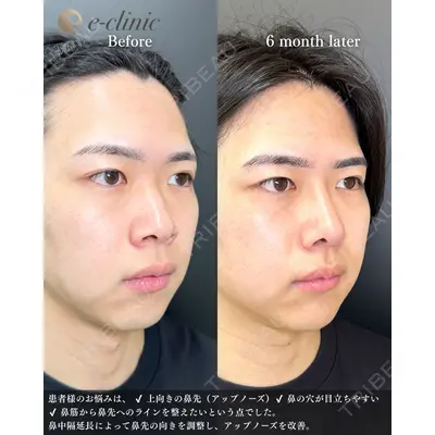 eクリニック 福岡院 伊藤 渉医師の症例