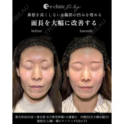 eクリニック 大阪院 八木 良太医師の症例