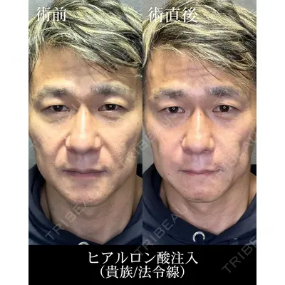 HAAB CLINIC 福岡院 米谷 拓朗医師の症例