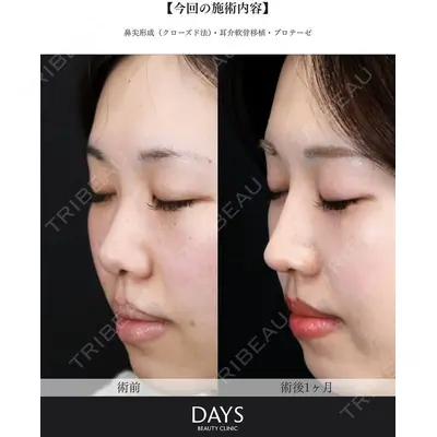 Days Beauty Clinic 新宿院の症例