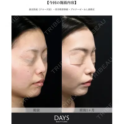 Days Beauty Clinic 新宿院の症例