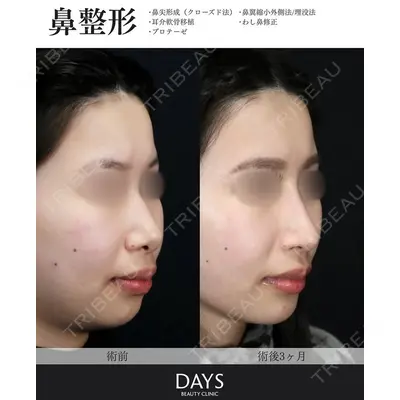 Days Beauty Clinic 新宿院の症例