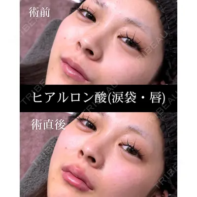 HAAB×DREAM BEAUTY CLINIC 大阪梅田院の症例