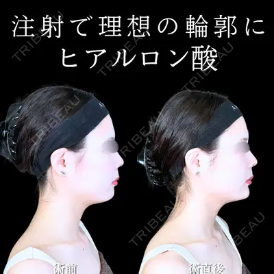 アリエル美容クリニック 水戸院 天白 典秀医師の症例