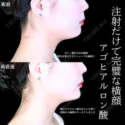 アリエル美容クリニック 水戸院 天白 典秀医師の症例
