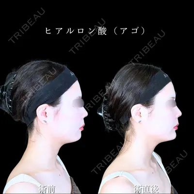 アリエル美容クリニック 水戸院 天白 典秀医師の症例