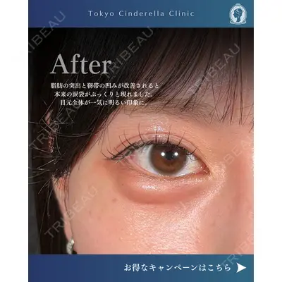 東京シンデレラ美容外科  横浜院 吉田 利之医師の症例