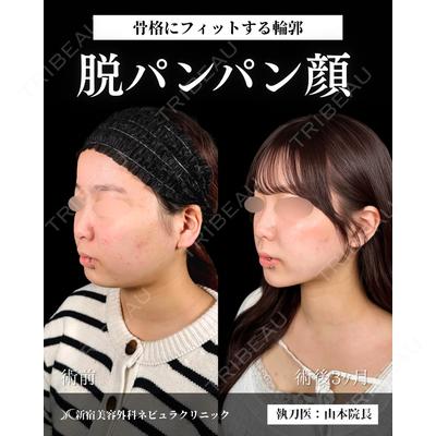 新宿美容外科ネビュラクリニック 山本 紘子医師の症例