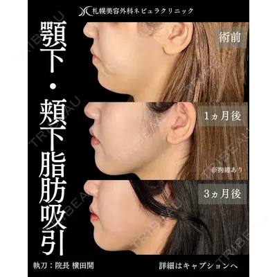 札幌美容外科ネビュラクリニック 横田 開医師の症例