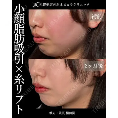 札幌美容外科ネビュラクリニック 横田 開医師の症例