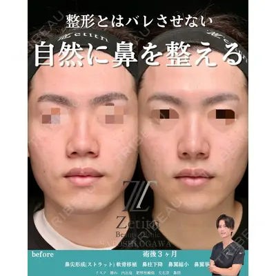 Zetith Beauty Clinic 銀座院 小川 悟史医師の症例