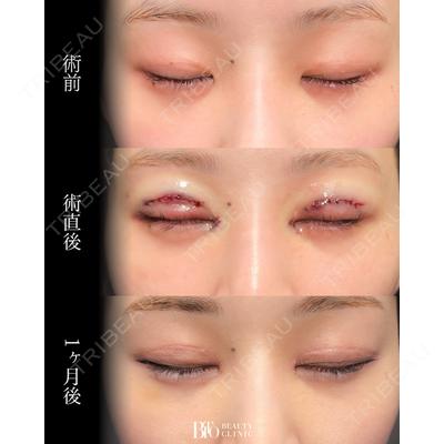 BITO BEAUTY CLINICの症例