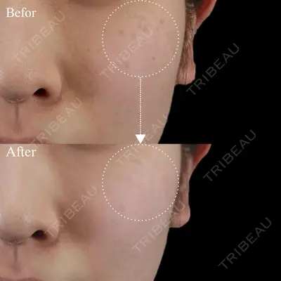 Days Beauty Clinic 銀座院の症例