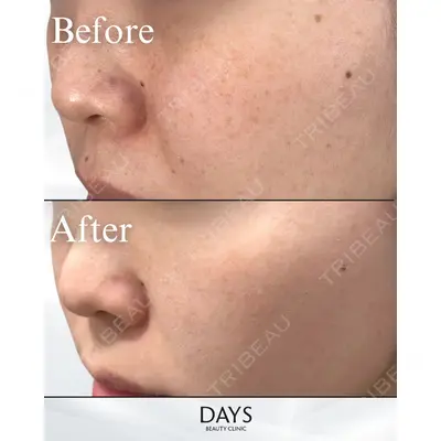 Days Beauty Clinic 銀座院の症例