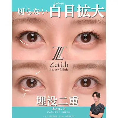 Zetith Beauty Clinic 銀座院 小川 悟史医師の症例