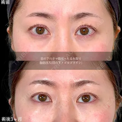 アリエル美容クリニック 水戸院 天白 典秀医師の症例